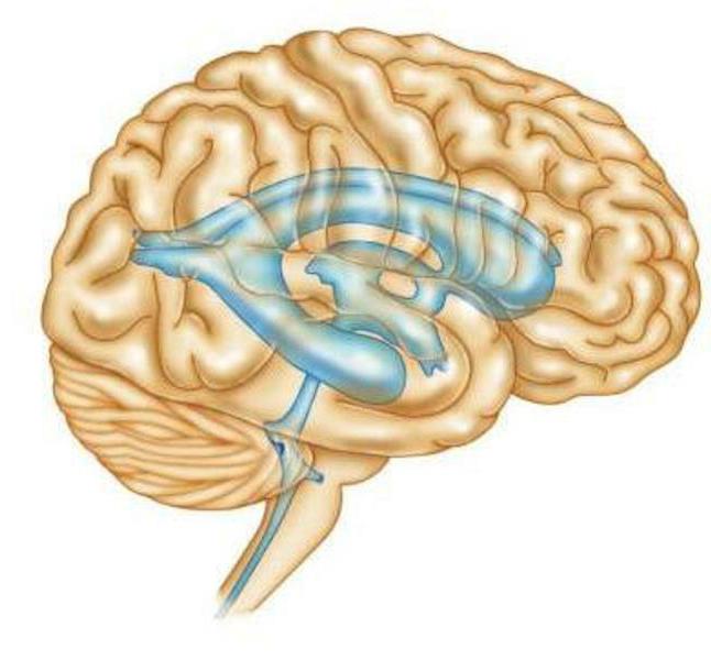 뇌의 측방 뇌실