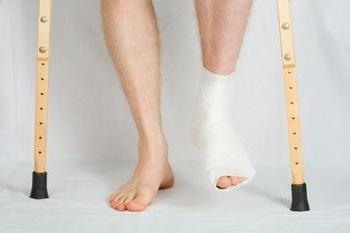 발 뒤꿈치의 골절 : 유형, 증상, 치료